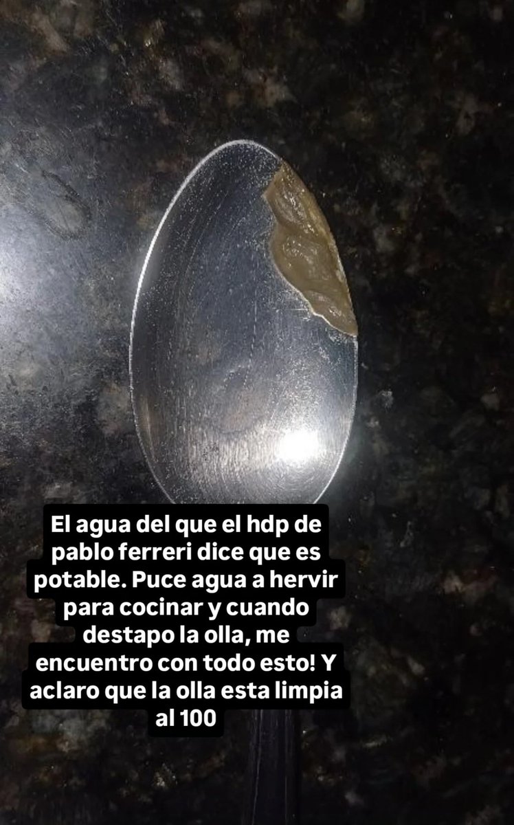 soloun4chica's tweet photo. esto es lo que hay en el agua "potable" de OSE 🤢 https://t.co/j8lYhrkUS9