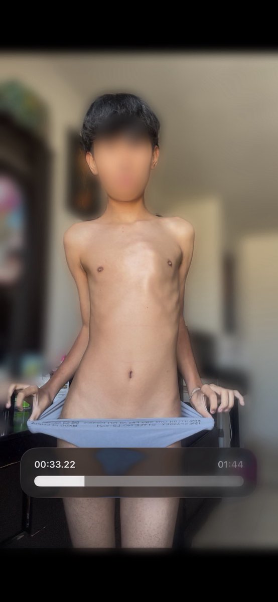 twink🔞 tweet media