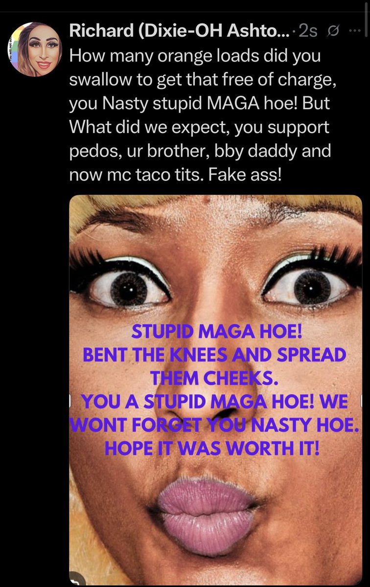 Rsantil24's tweet photo. @NICKIMINAJ Anyone listening to list weirdo has issues https://t.co/brzPEKj2YZ