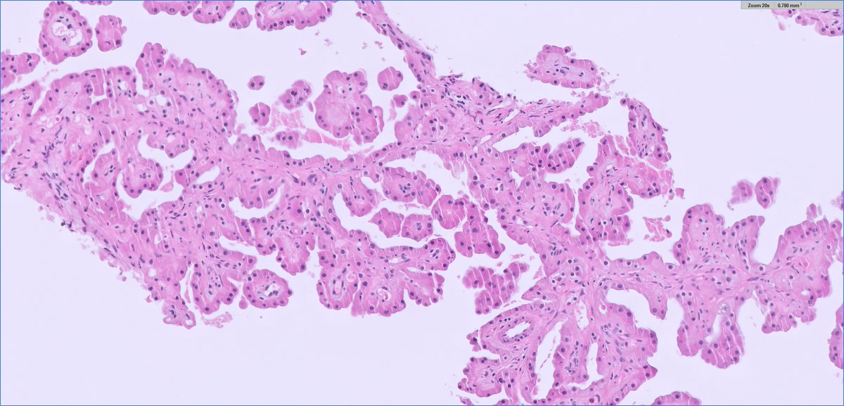 Ankur Sangoi tweet media