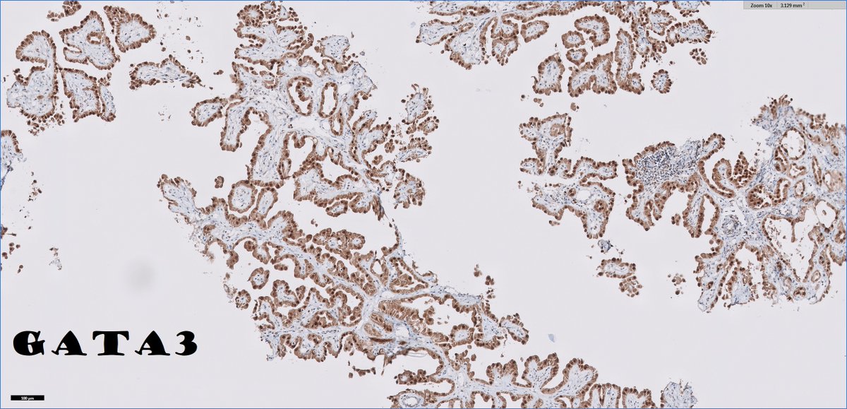 Ankur Sangoi tweet media