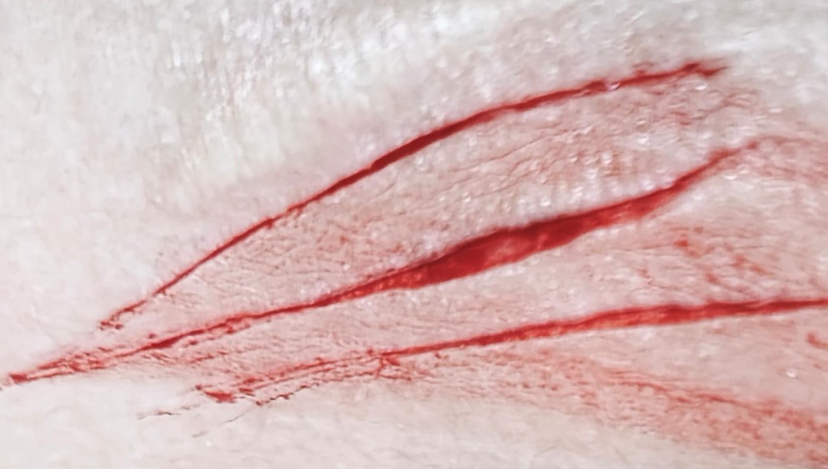 Ou yeaaa #shtwt #sh #selfharm #cuts