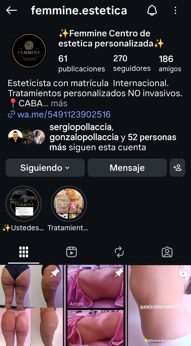 Después de recibirme de esteticista y trabajar durante 4 años en un centro de estética , pude abrir mi propio lugar. 
Les pido porfa si pueden compartir y seguirme en Instagram me ayudaría mucho. Gracias !  ✨femmine.estetica✨