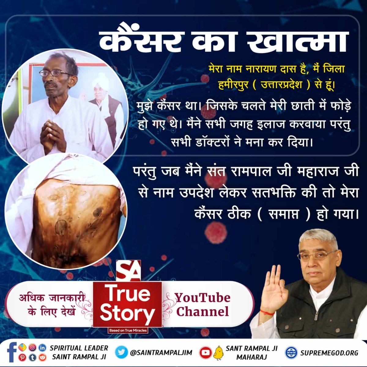 #TrueWorship_CuresCancer
मेरा नाम नारायण दास है, मैं जिला हमीरपुर
मुझे कैंसर था। जिसके चलते मेरी छाती में फोड़े हो गए थे। मैंने सभी जगह इलाज करवाया परंतु सभी डॉक्टरों ने मना कर दियाbसंत रामपाल जी महाराज जी से नाम उपदेश लेकर सतभक्ति की तो मेरा कैंसर ठीक हो गया
Sa TrueStory YouTube