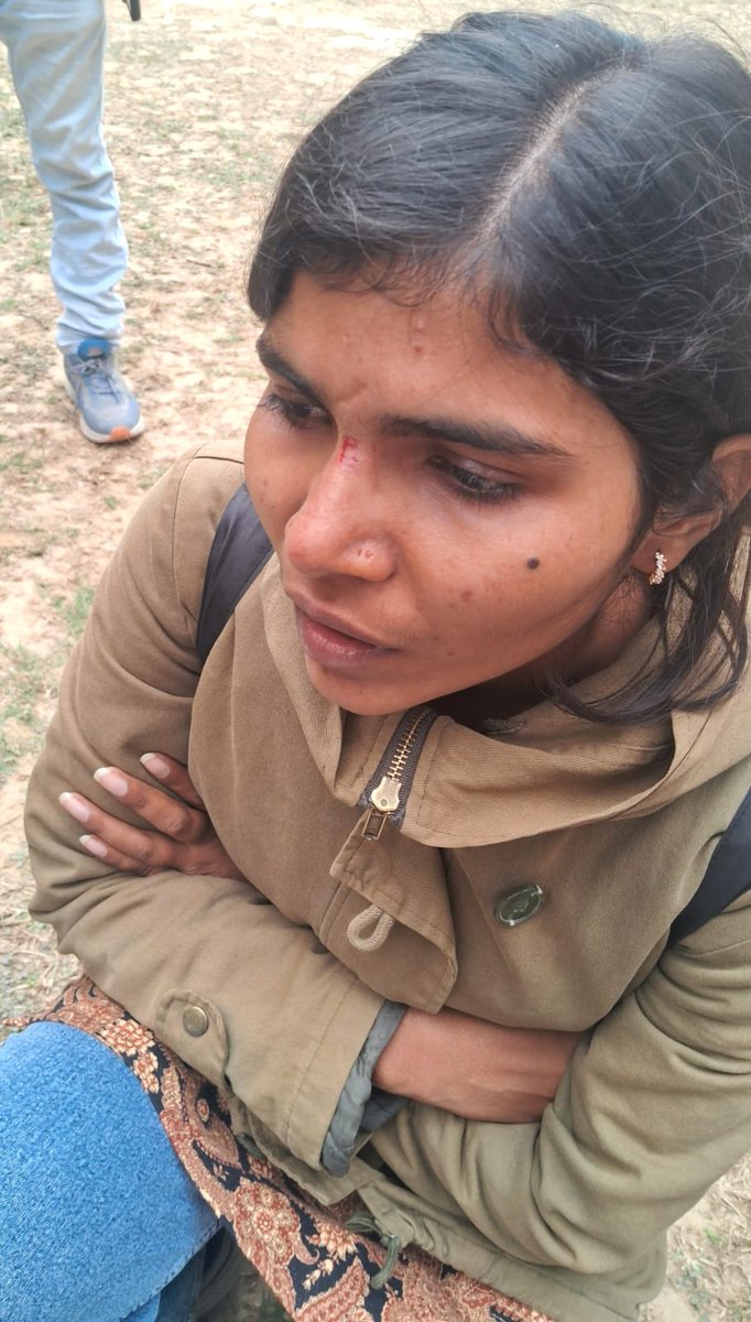 ये इलाहबाद यूनिवर्सिटी की छात्रा अंजली शुक्ला हैं,
ये UGC के समर्थन में प्रदर्शन कर रही थी यूनिवर्सिटी में,

अंजलि शुक्ला का कहना है कि ऐसा करने पर 
बजरंगदल और ABVP के गुंडों ने उनपर हमला किया है,

अंजली के चेहरे पर चोट के निशान हैं,
पुलिस कार्रवाई नहीं कर रही है,