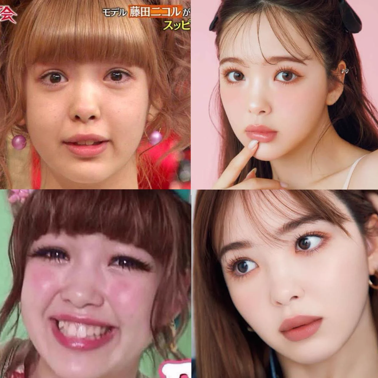 藤田ニコル整形