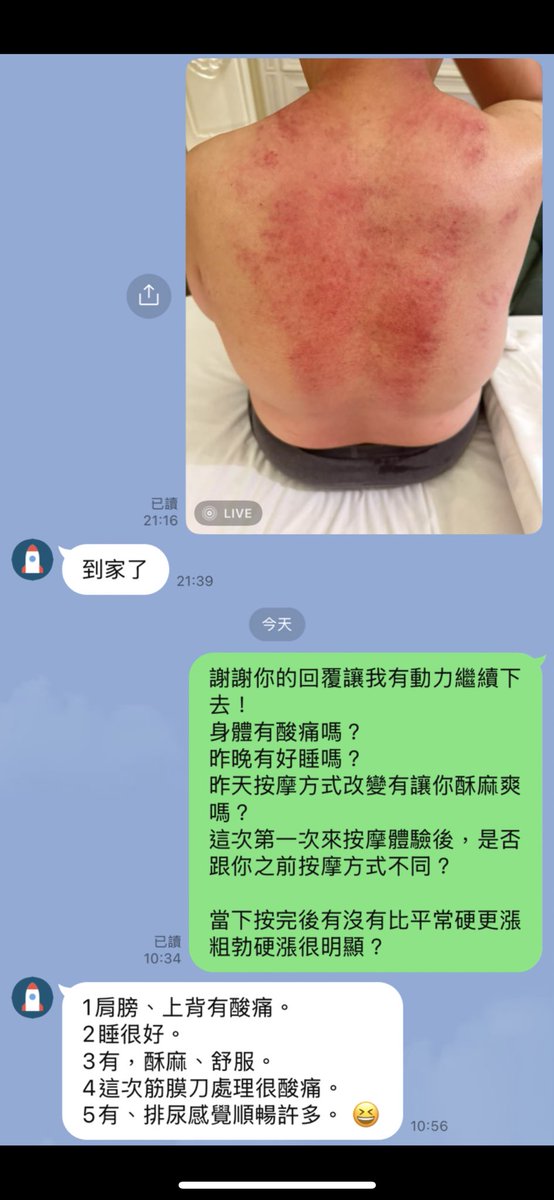 eff09333's tweet image. 謝謝花蓮的你來按摩調理，半年沒有見了，也聽到換了更好工作替你開心的事。
好好走出自己👀片天空，學會主動溝通聊天，這樣才會有好的桃花戀愛。
總是按完後回家好睡覺。
有酥麻爽爽感受。筋膜刀ㄧ定會酸痛而已
但是也會讓你身體代謝乾淨排尿更好