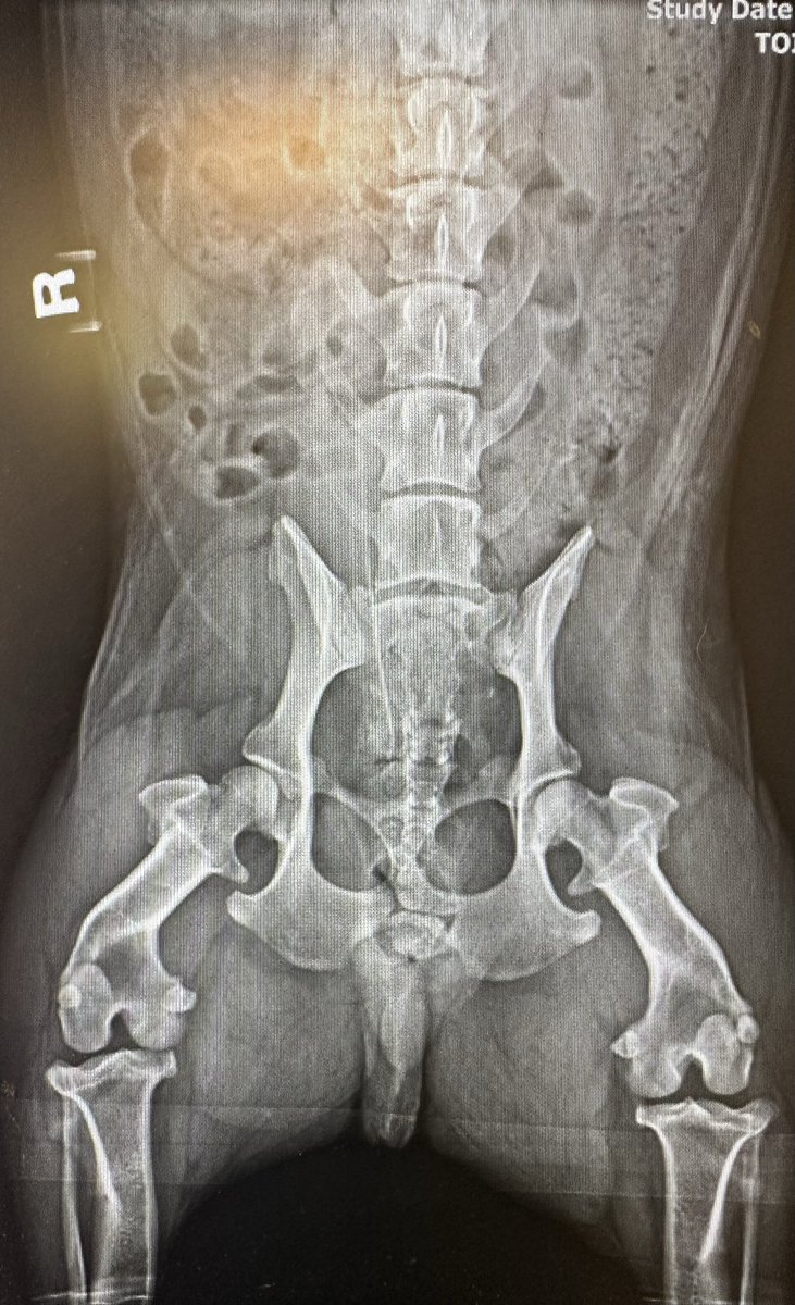 Jacob Fleming, MD tweet media