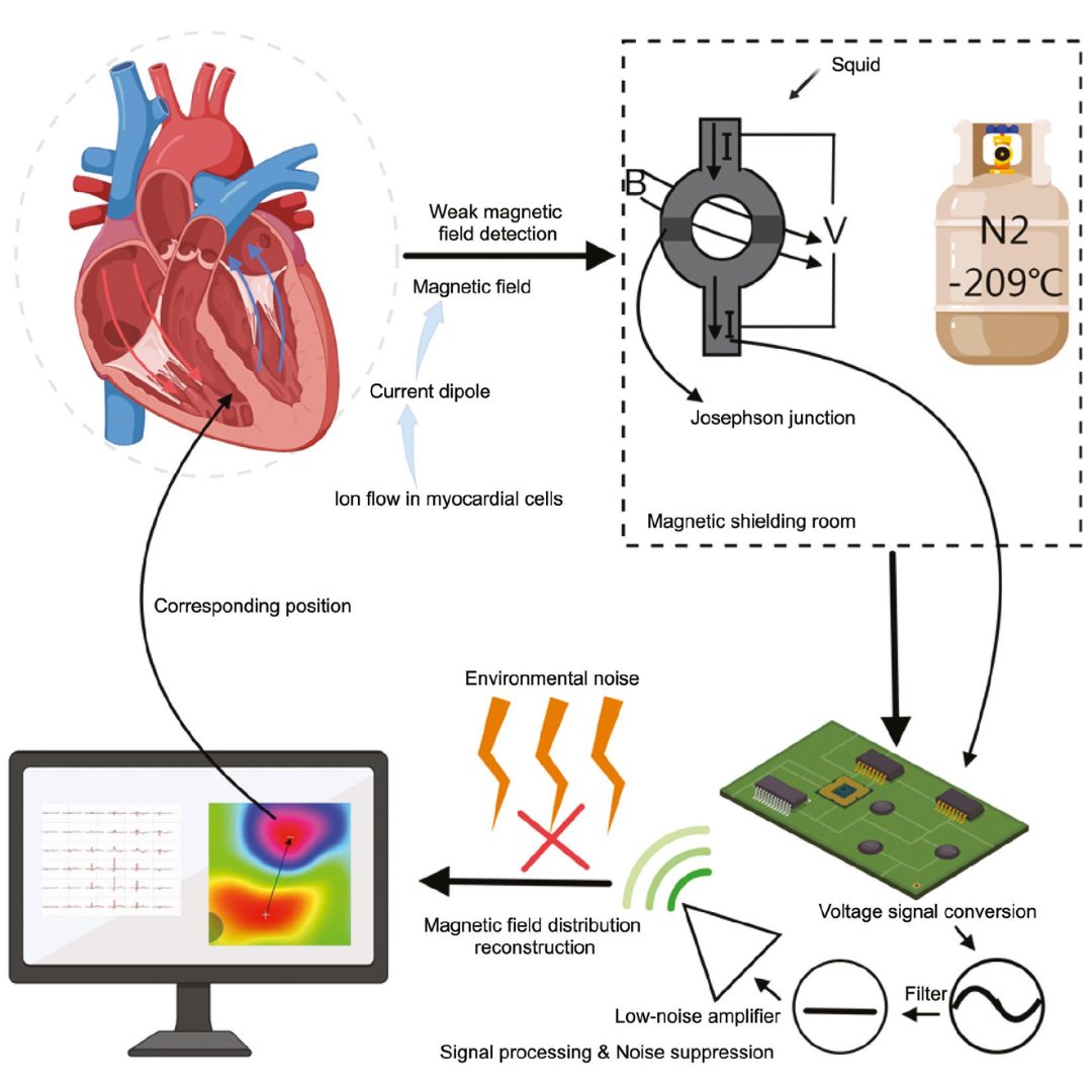Iramiei's tweet photo. ““Magneto Cardiography (MCG) is a non-invasive, radiation-free tool for early detection of heart diseases. It has the potential to transform cardiology in China and improve patient outcomes.” 💓 https://t.co/uuXqpVgkRm