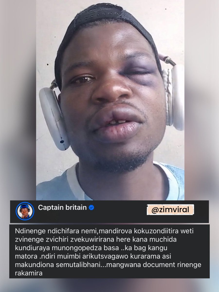 ZimViral's tweet image. 