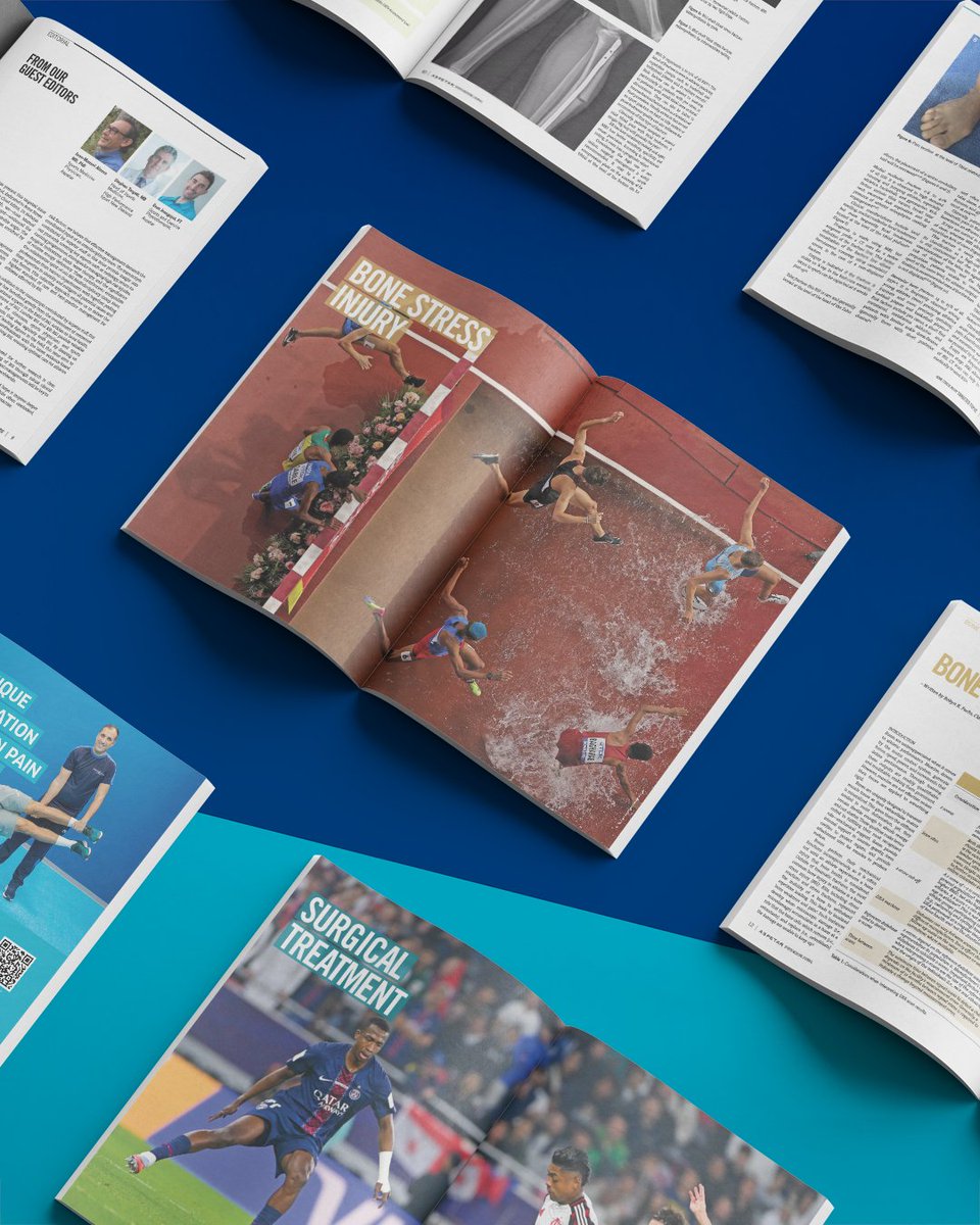 Aspetar's tweet photo. 🆕 The latest Aspetar Sports Medicine Journal is out now.

🎯“Targeted Topic: Bone Stress Injury”🎯

✍️ special issue explores bone stress injuries as a major yet often hidden threat to athletic performance, highlighting their evolution, impact, and the critical role of early diagnosis, prevention, and recovery.

🔗Get Your Free Copy Now 👉 https://t.co/w5Iy0Ikx7o