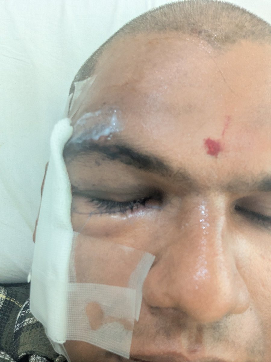 SKumarInTech's tweet photo. @hydcitypolice 
@KimsSunshineHos 

The poc of your hospital has denied medical services and assisted in assault of me

I gonna sue hospital tmr Thursday 

I came in emergency ambulance and as a hospital of law denying

 emergency services is q sin https://t.co/tPspJ474JB