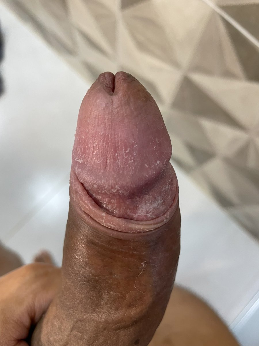 Master Castro BR 👣 tweet media