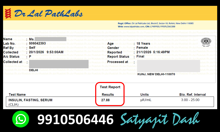 dsatyajit's tweet image. #New #case
Young adult 18Y/F.

✅PCOS
✅Chronic Insulin Resistance
✅Fasting insulin 27.88

-&amp;gt; Put Into TCR protocol
-&amp;gt; with basic nutritional supplements.
-&amp;gt; shall update the progress after 3 months.