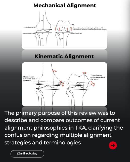 Arthroplasty Today tweet media