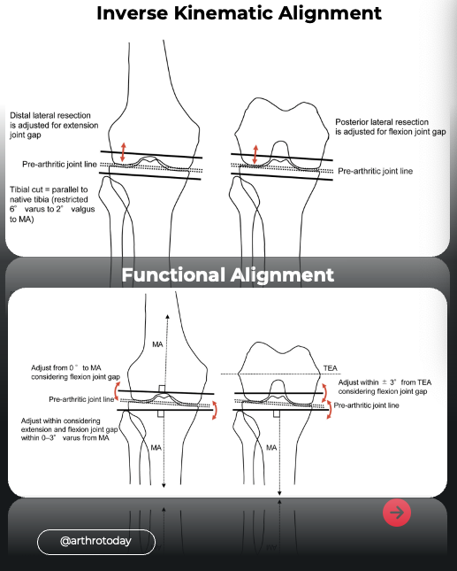 Arthroplasty Today tweet media