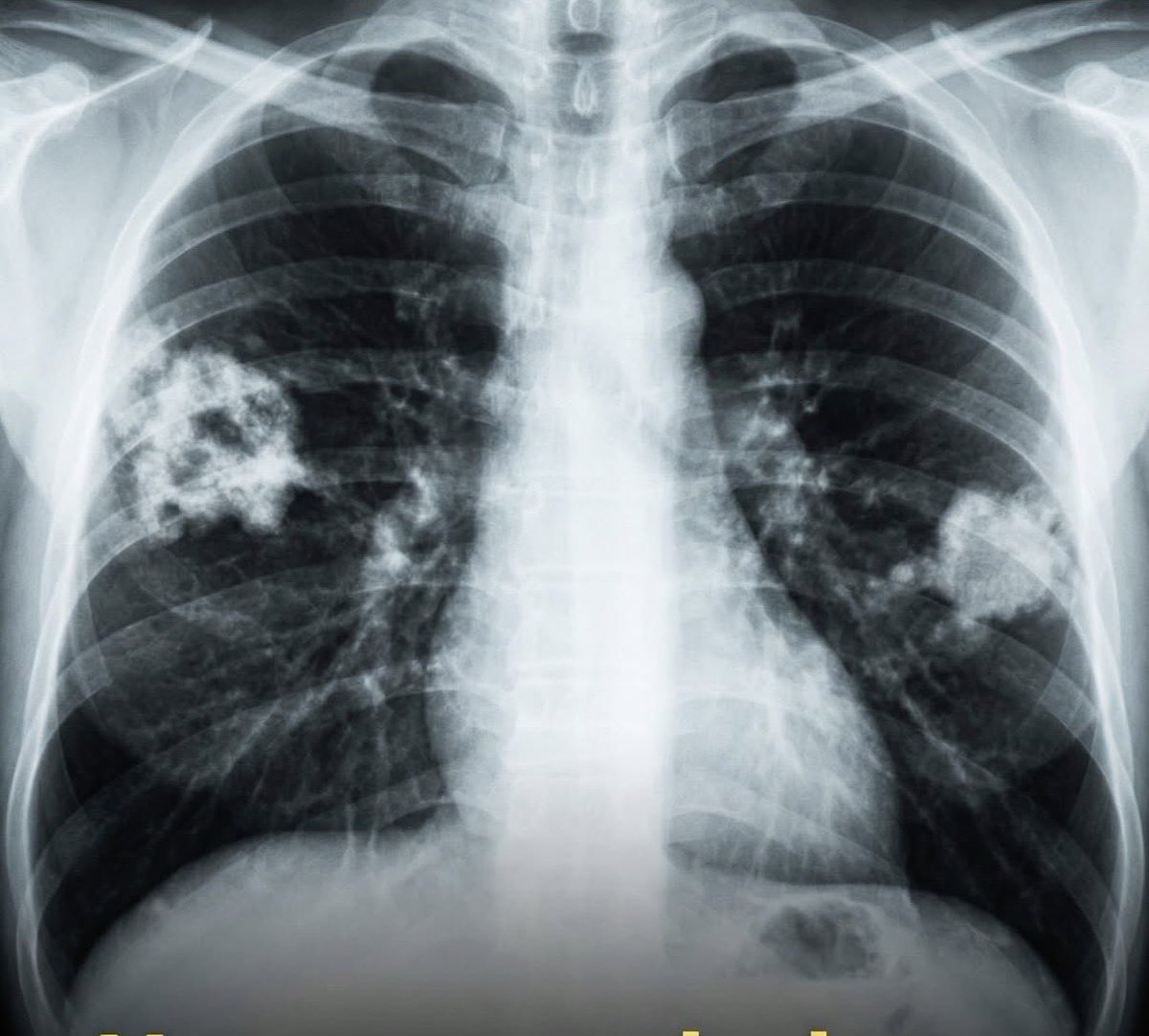 Matteo Bassetti tweet media