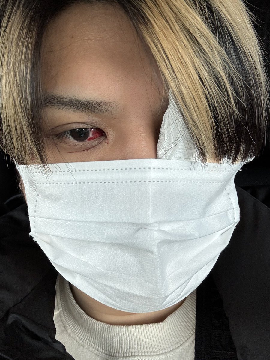 ksms08996431's tweet photo. 手術で血の涙が止まらない https://t.co/E8I4J7MW81