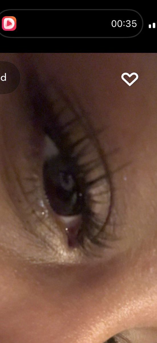 i’ve been doing an analysis of my eye color, same color as dark chocolate 
my pupils are huge in these