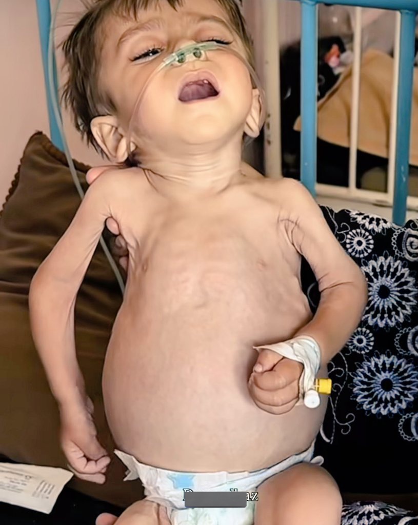 Yousef in Gaza 🇵🇸 tweet media