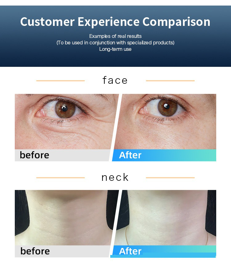 GSincohere22923's tweet image. 448KHz Fever Therapy Machine for Skin Tightening &amp;amp; Deep Heating Treatment

#448KHzFeverTherapy #SkinTighteningMachine #DeepHeatingTreatment #FeverTherapyDevice #SkinTighteningTool #DeepSkinHeating #448KHzBeautyDevice #AntiAgingMachine