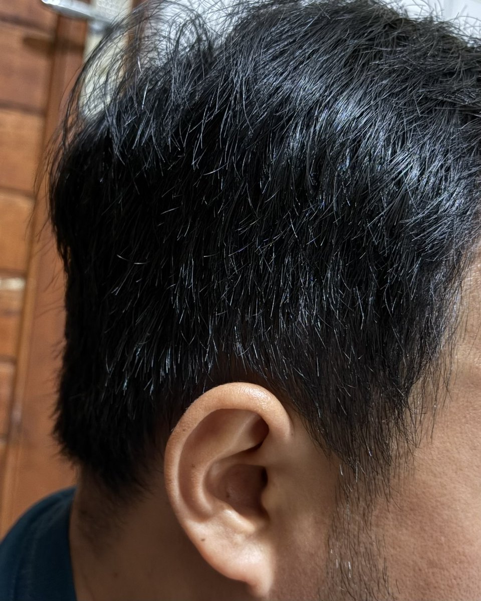 minyak kemiri its really works!!

bikin rambut tebel, hitam, gak gampang lepek, dan harganya cuma 8 ribu 👌🏻