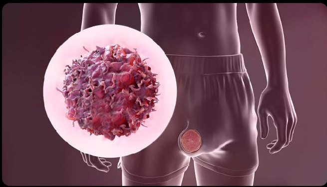 Ninja__Wisdom's tweet photo. This overlooked part of your body affects:

• Sperm count
• Testosterone levels
• Cancer risk

The scary part? 9 in 10 men neglect it.

Here’s what every man should know about his testicular health (&amp; how to protect it before it’s too late): 🧵 https://t.co/7kx29qol06