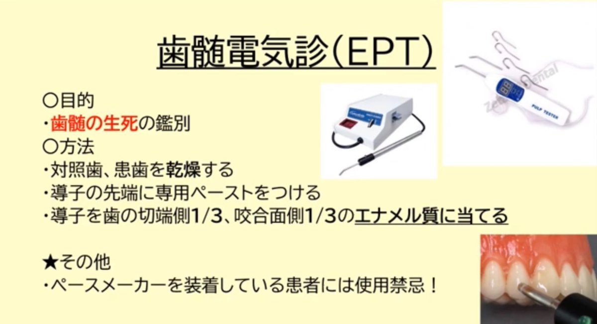 ⭕️電気歯髄診について 写真を見てこれが何をしているかを分かるよう