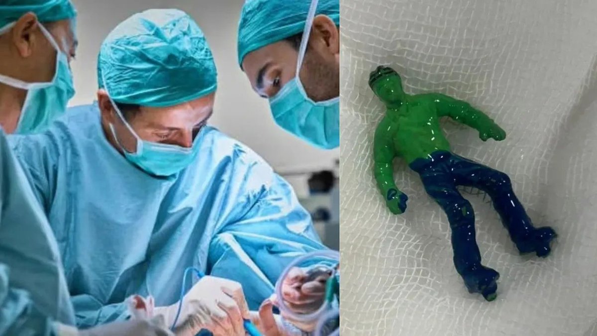 thenewsdrum's tweet image. Toddler swallows ‘Hulk’; doctors remove toy via endoscopy
newsdrum.in/national/toddl…

#Toddler #Hulk #Ahmedabad #Medical #Gujarat #ViralNews #Toys #Kids