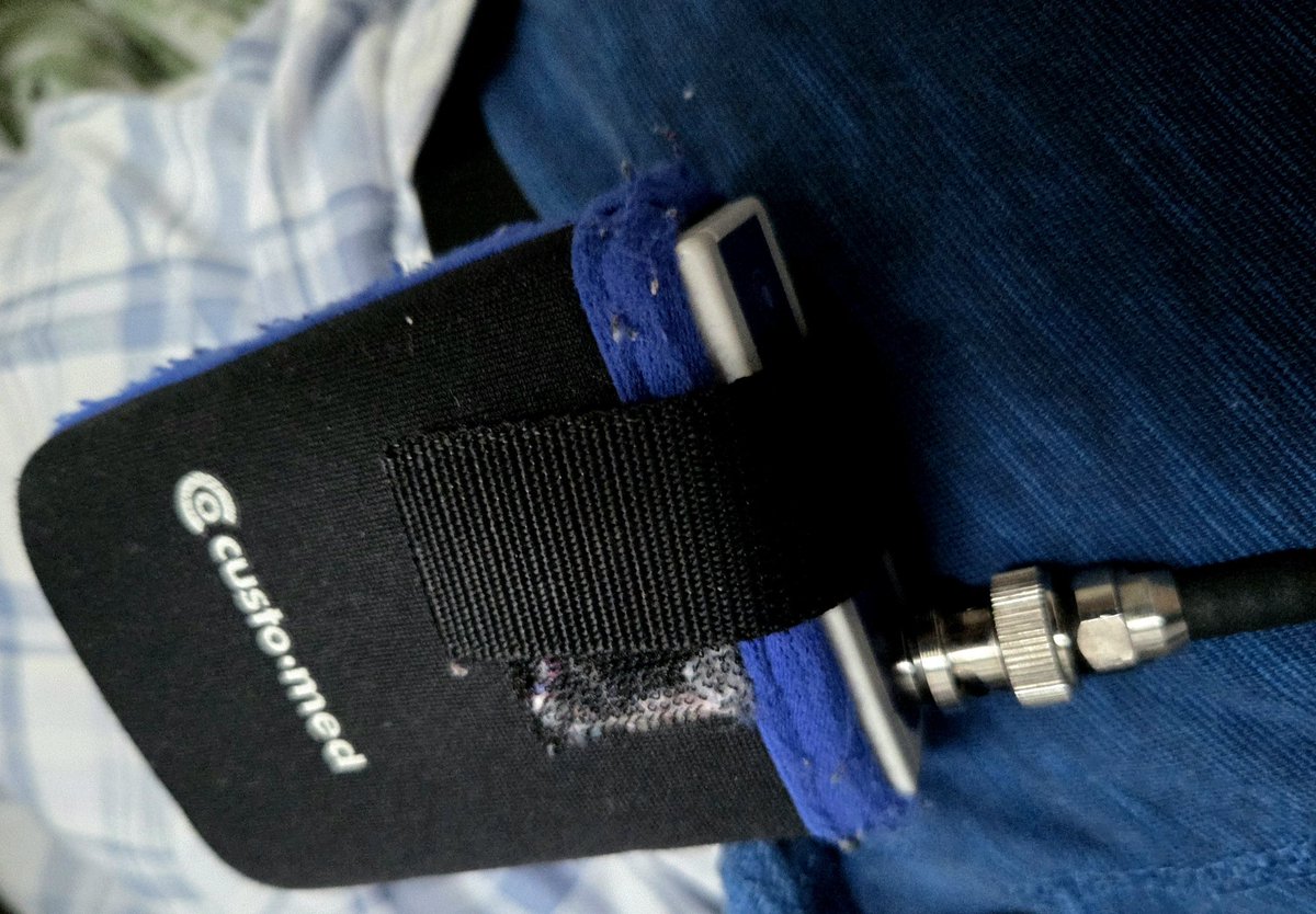 oldnurse55's tweet photo. Bringing this 'Walkman' back to the suppliers.
Can't get any reception on it at all. 🎵🎼🙄
#bpmonitor https://t.co/E3wYc4LrHc
