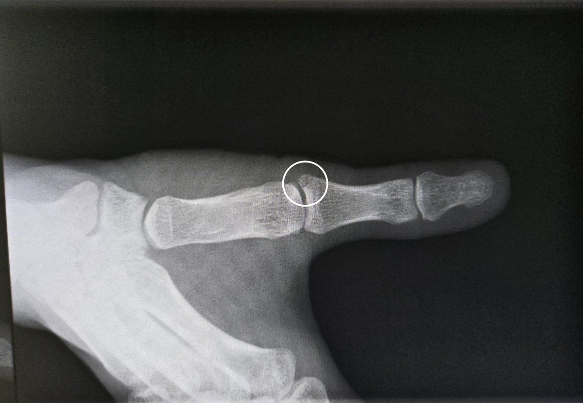 あかぎ tweet media