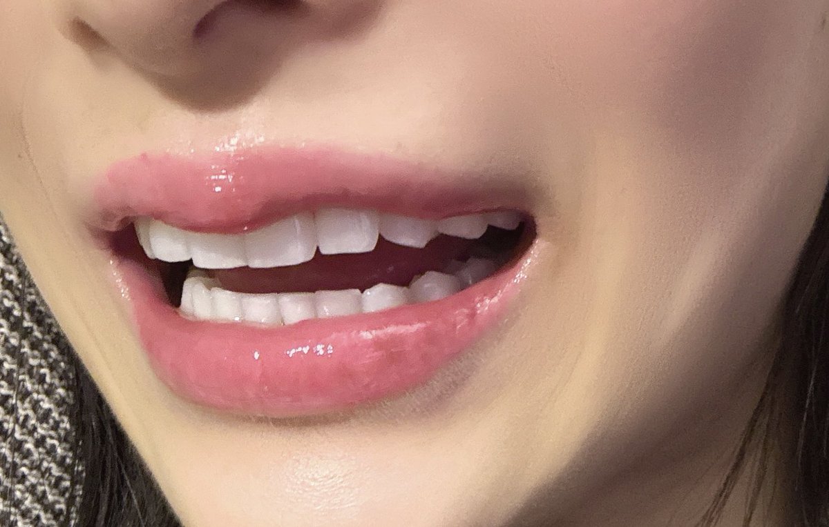 きららちゃん✨ (@p_kira1) / Posts / X