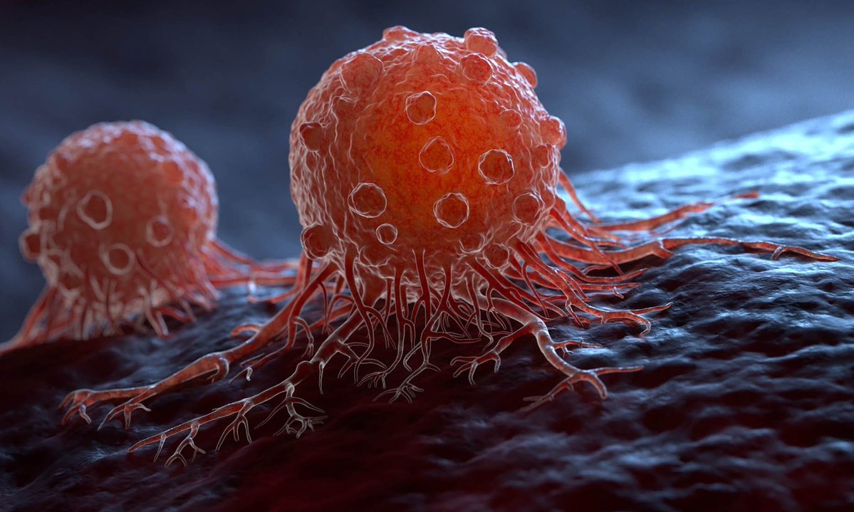 BREAKING:

Spanish scientist Mariano Barbacid needs about $35. million to begin human clinical trials of a pancreatic cancer treatment that eliminated tumors in mice.