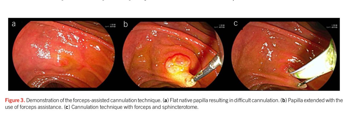 Achintya Singh, MD tweet media