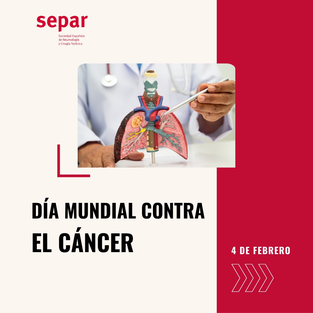 🫁 El cáncer de pulmón sigue siendo un gran reto, pero detectar a tiempo puede salvar vidas.

📊 Descubre cifras y avances en cribado precoz que marcan la diferencia 👇

🔗 n9.cl/2u5hp

#DíaMundialContraElCáncer #CáncerDePulmón #Prevención #SEPAR #SaludRespiratoria