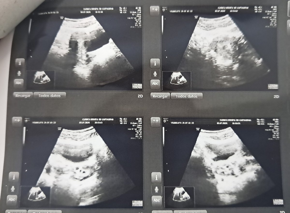 Yiyi☆ PD: I'm Chris tweet media