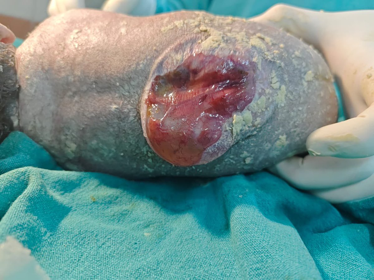 Dr.Akhi_The Gynesaur🤰🏻 అఖిల tweet media