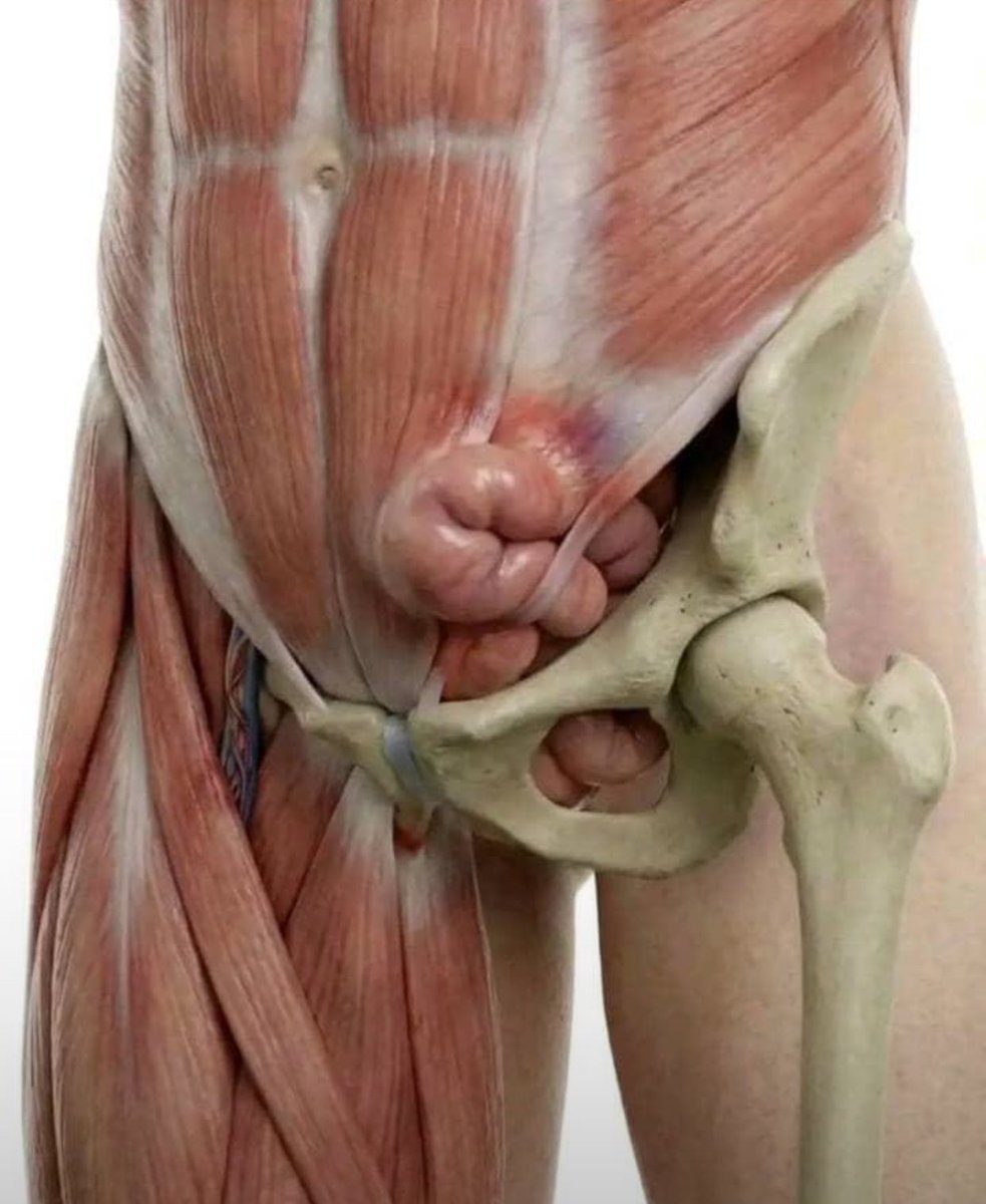 What is the diagnosis?