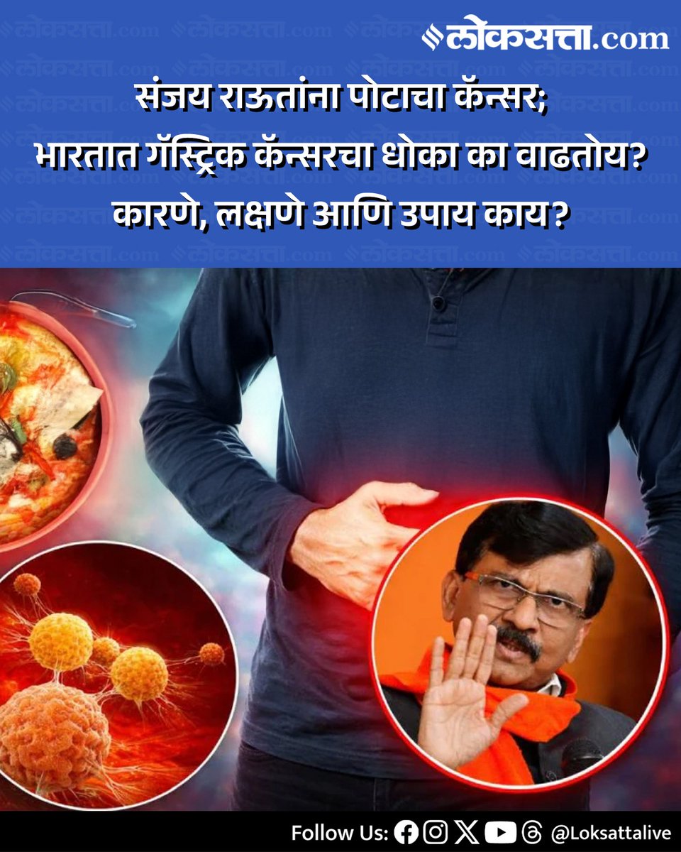 LoksattaLive's tweet photo. संजय राऊतांना पोटाचा कॅन्सर; भारतात गॅस्ट्रिक कॅन्सरचा धोका का वाढतोय? कारणे, लक्षणे आणि उपाय काय?
https://t.co/UULlvg6NCh < येथे वाचा सविस्तर वृत्त
#Marathinews #Sanjayraut #Helath #cancer https://t.co/fArmsmY2ss