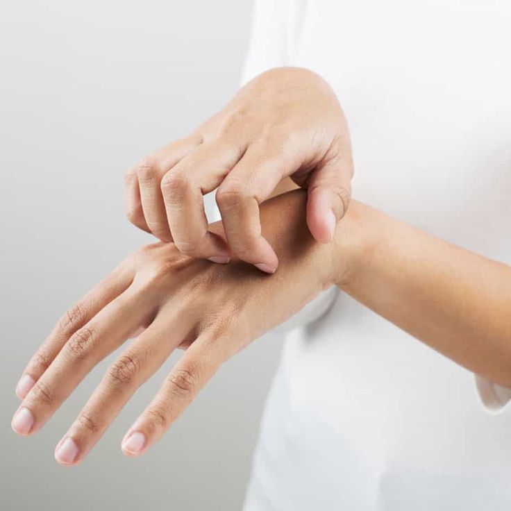 updatesjekeyti's tweet image. Oguri Yui reveals experiencing itchiness while wearing Evelyn’s costume.