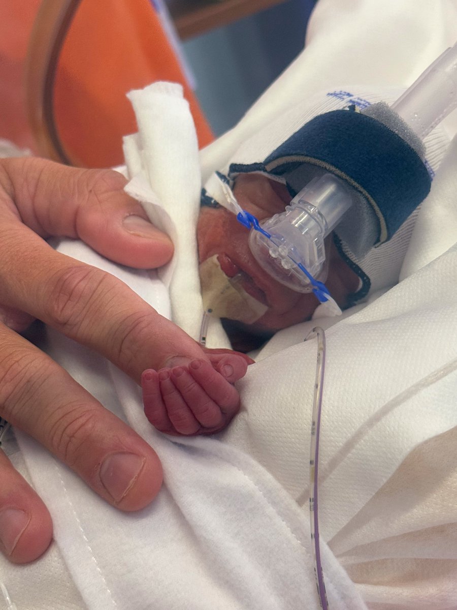 Buck Robinson tweet media