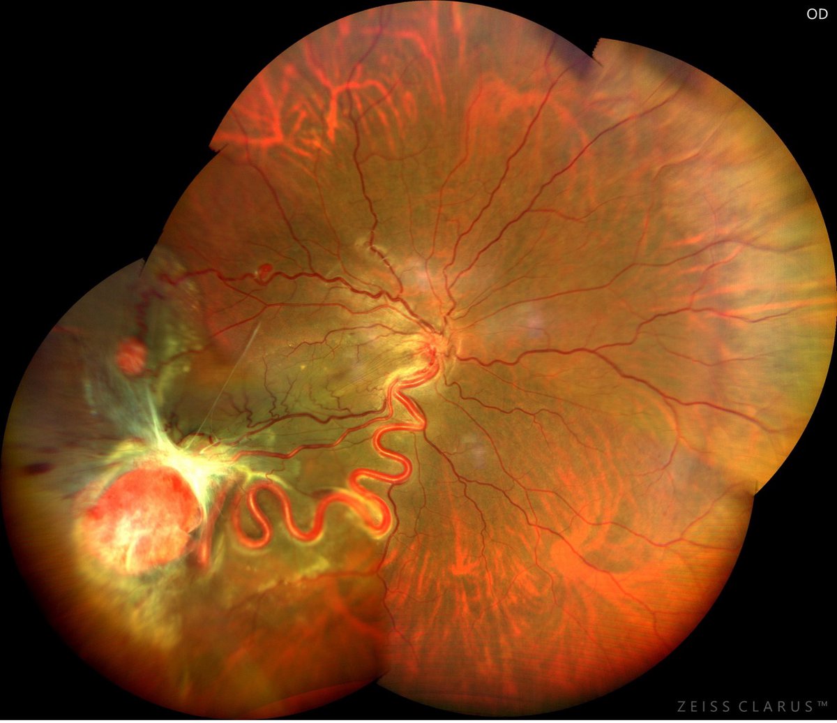 Ophthalmology 360 tweet media