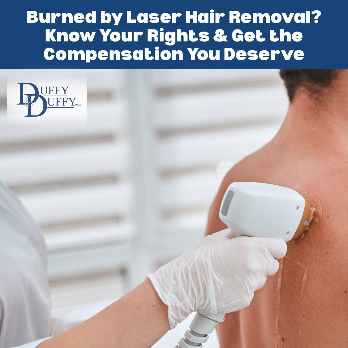 Burned during #LaserHairRemoval? You may have legal options for medical costs, pain &amp; suffering, and lost income. Protect your rights with #DuffyAndDuffyLaw. 

buff.ly/NzBU7Qj

#LaserBurn #MedicalMalpractice #LongIsland