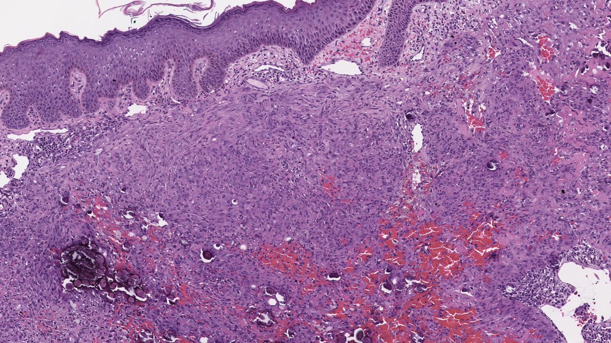 Meredith Herman, DO tweet media