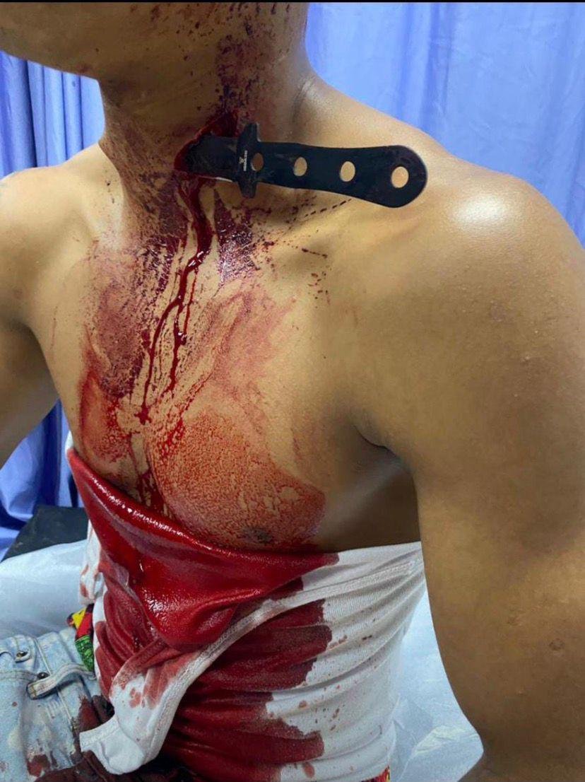 atracosrd's tweet photo. El Usuario: Saludos, iban a atracar a ese muchacho en Yamasá, y le clavó ese cuchillo al atracador. https://t.co/FMOEUovsc1