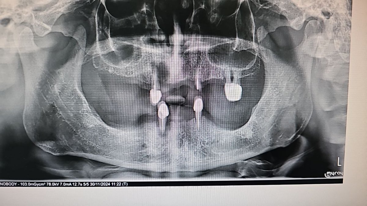 ibrahim ozan mutlu tweet media