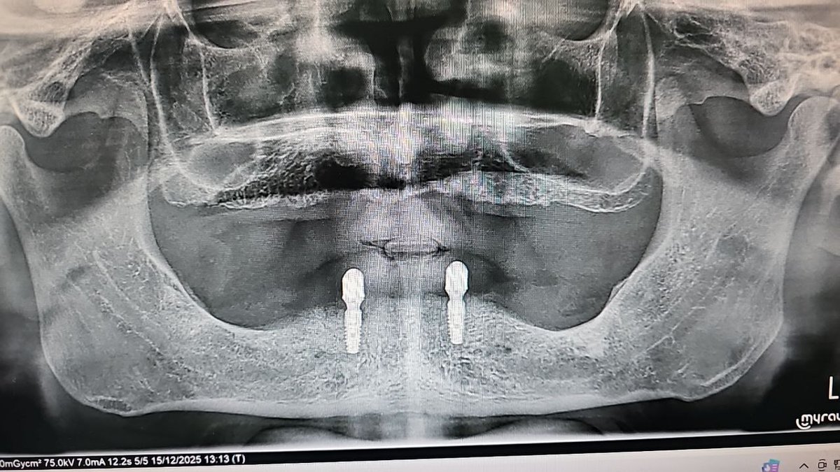 ibrahim ozan mutlu tweet media