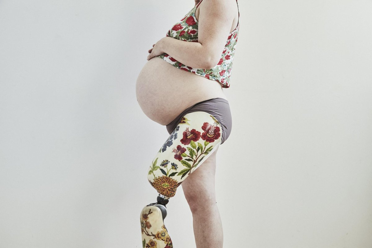 CAN A PREGNANT WOMAN WHO IS AN AMPUTEE  HAVE A VAGINAL DELIVERY 

READ. SHARE.  REPOST 

THIS IS A VERY IMPORTANT READ. 

Dear X users, 

Come, sit with me for a moment, and let me answer you the way I would in clinic, with my stethoscope resting on the table and my heart leaning