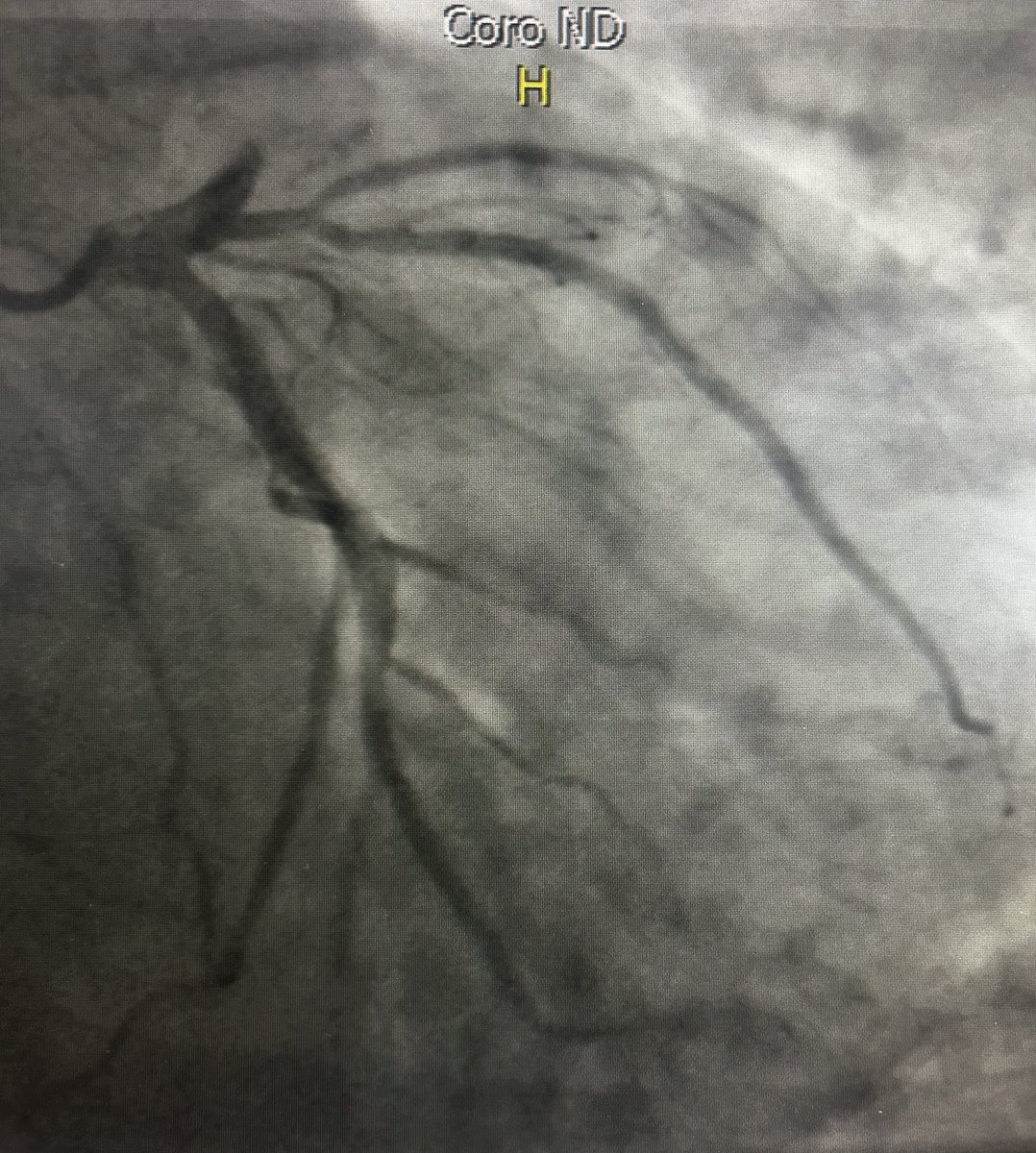 Leonardo E. Saavedra, MD, FACC tweet media