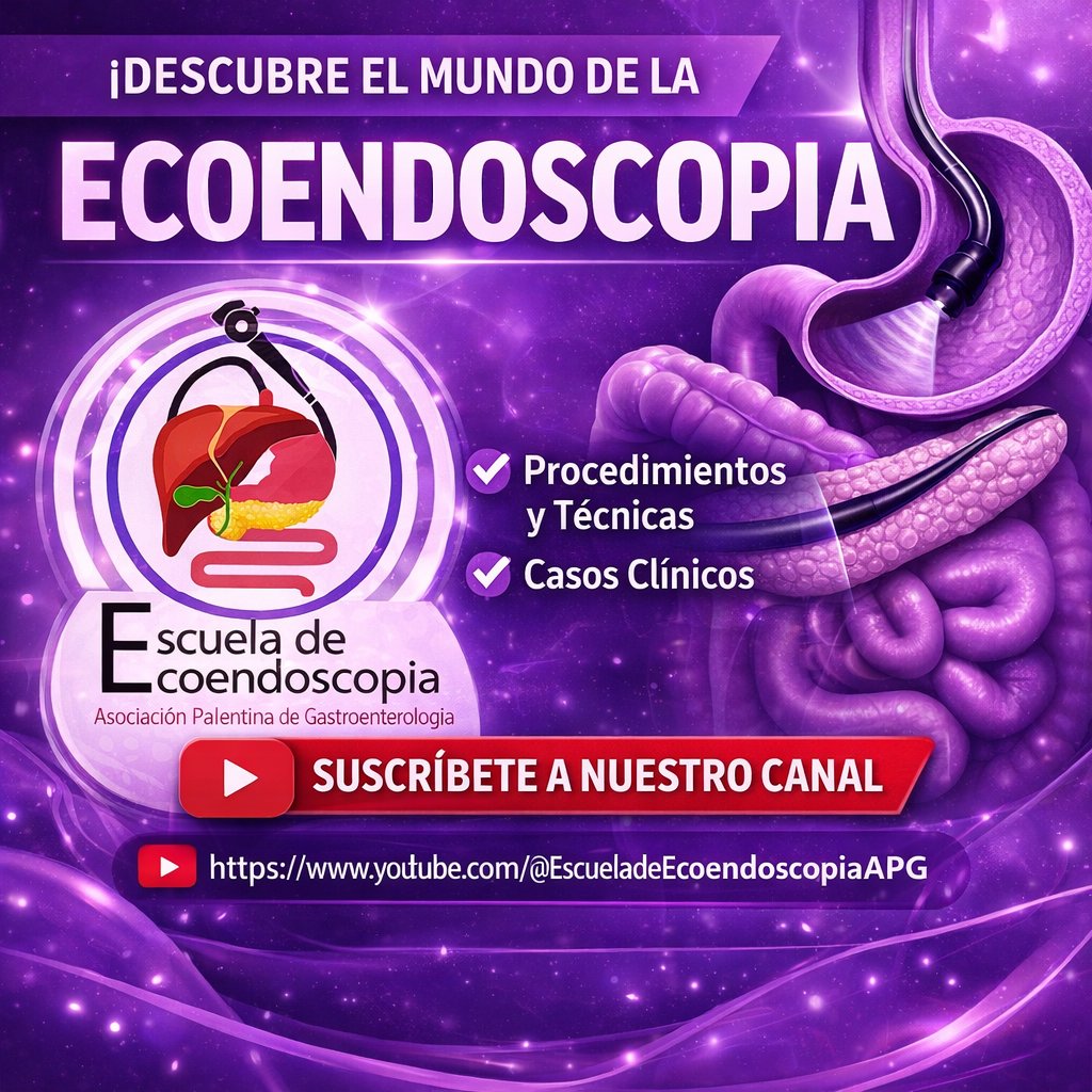 🔍💜 ECOENDOSCOPIA
Casos clínicos reales y técnicas avanzadas en gastroenterología.
▶️ Síguenos y suscríbete
📺 youtube.com/@EscueladeEcoe…
<a href="/GIscope_updates/">EUS & ERCP Master</a> <a href="/SEEDendoscopia/">SEED</a> <a href="/endoscopyjrnl/">Endoscopy Journal</a> 
#Ecoendoscopia #Endoscopia #Gastroenterología #Medicina #EUS